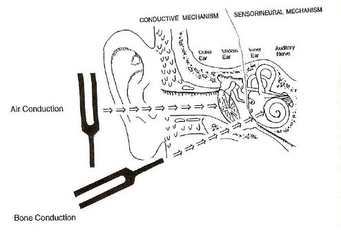 Bone conduction